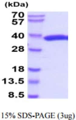 Novus Biologicals&trade;&nbsp;Firefly Luciferase Recombinant Protein
